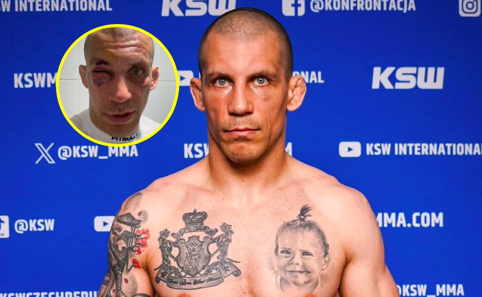Pokazał twarz po walce na KSW. "Muszę sobie zrobić dłuższą przerwę"