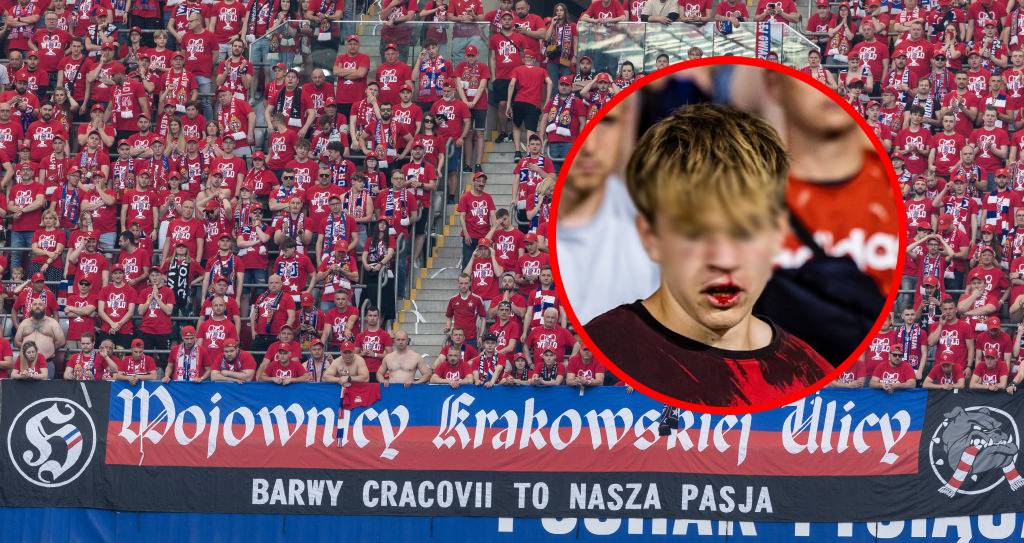 Pobito młodego kibica Wisły Kraków! Skandal w I lidze