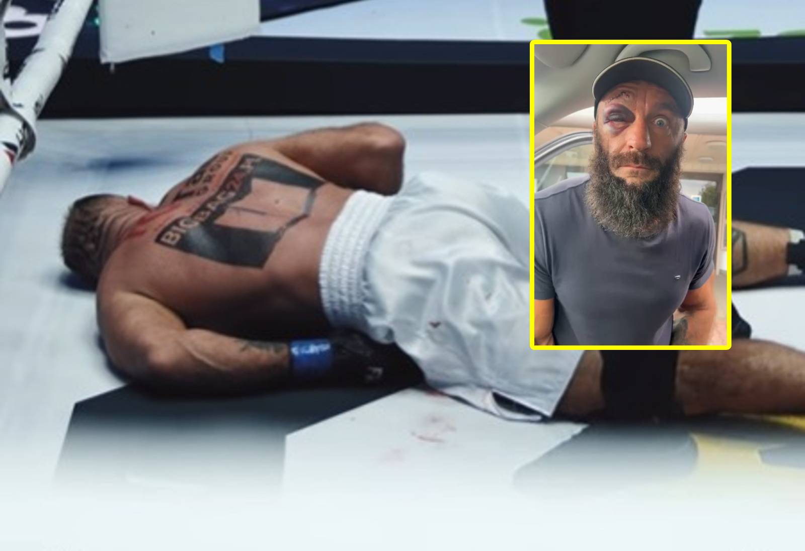 Został znokautowany przez Materlę. Z rana pokazał swoją twarz