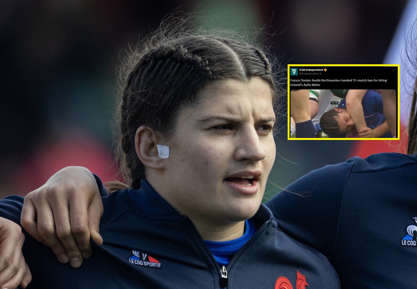 Skandaliczne zachowanie Francuzki. Oto kara za ugryzienie rywalki