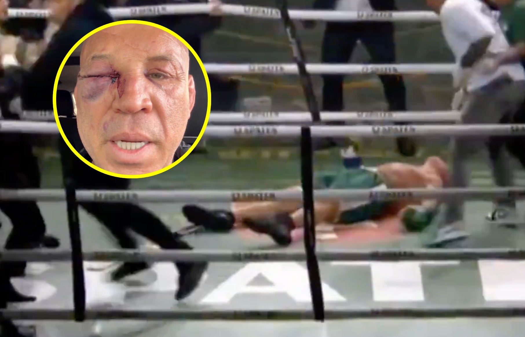 Awantura po walce. Gwiazdor znokautowany