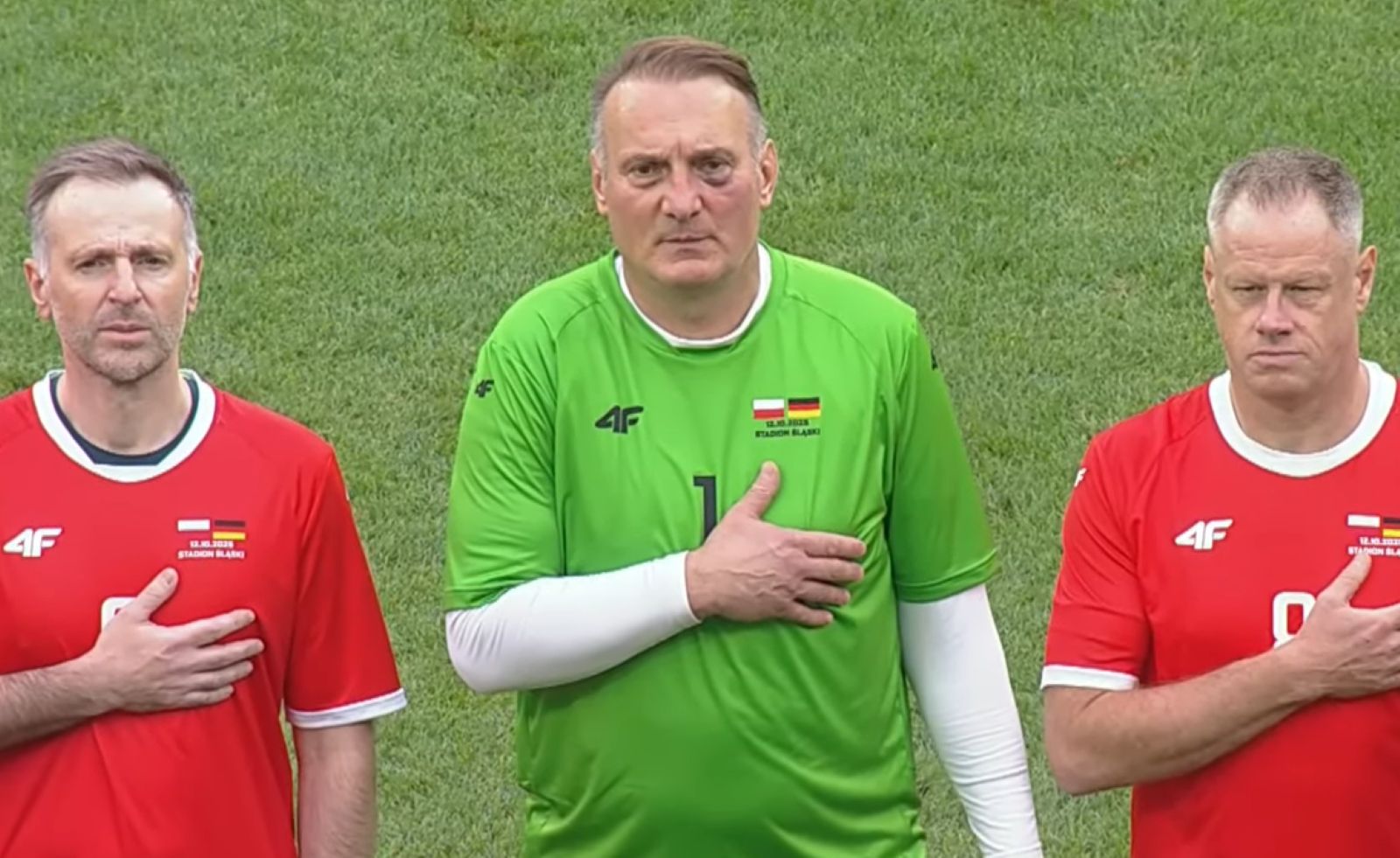 Mecz Legend: dramat na rozgrzewce! Bramkarz trafił do szpitala zamiast na boisko