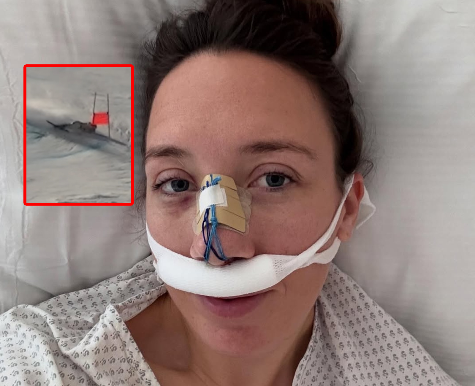 Koszmarny wypadek olimpijki. Wylądowała w szpitalu