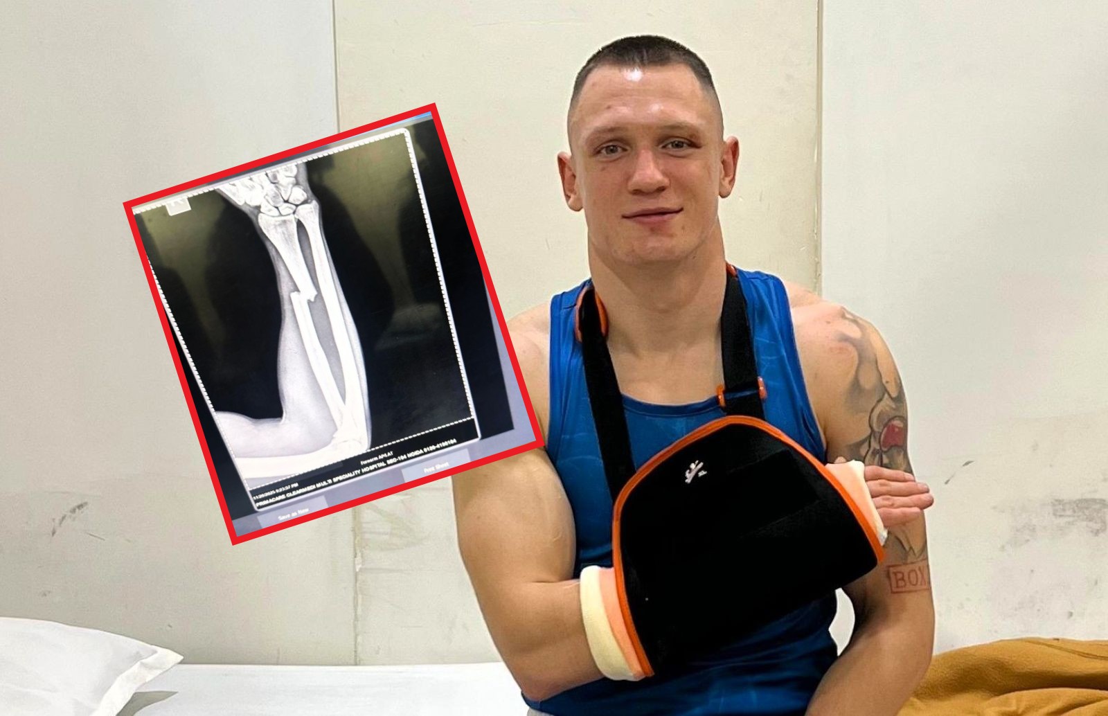 Tylko zobacz, co się stało z ręką polskiego mistrza. Od razu trafił do szpitala