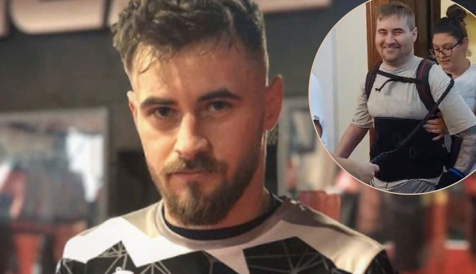 Gdy pokazał się po raz pierwszy od wypadku, wielu go nie poznało. Dziś wygląda inaczej