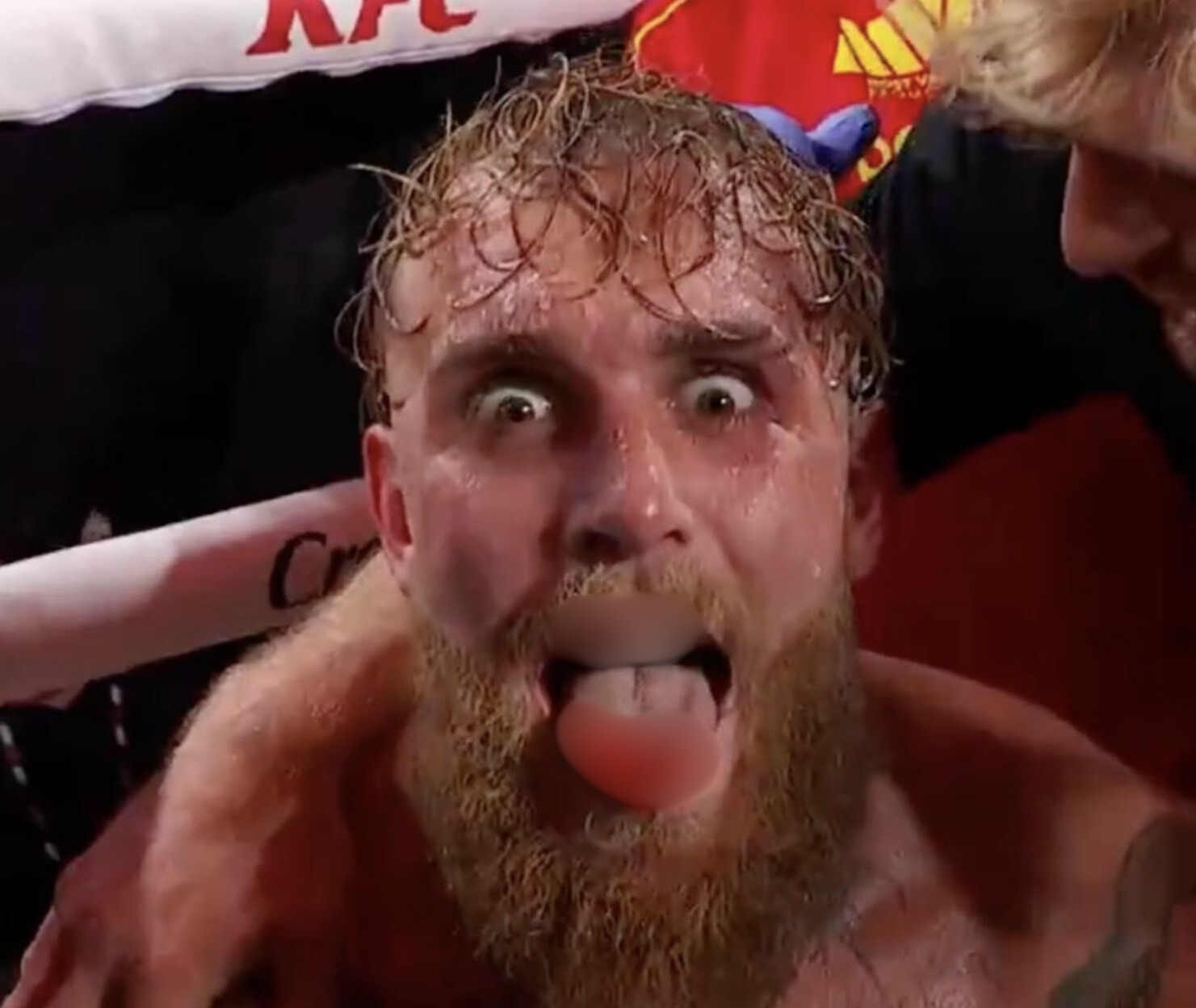 Tak wyglądał Paul po walce. Miliony wyświetleń