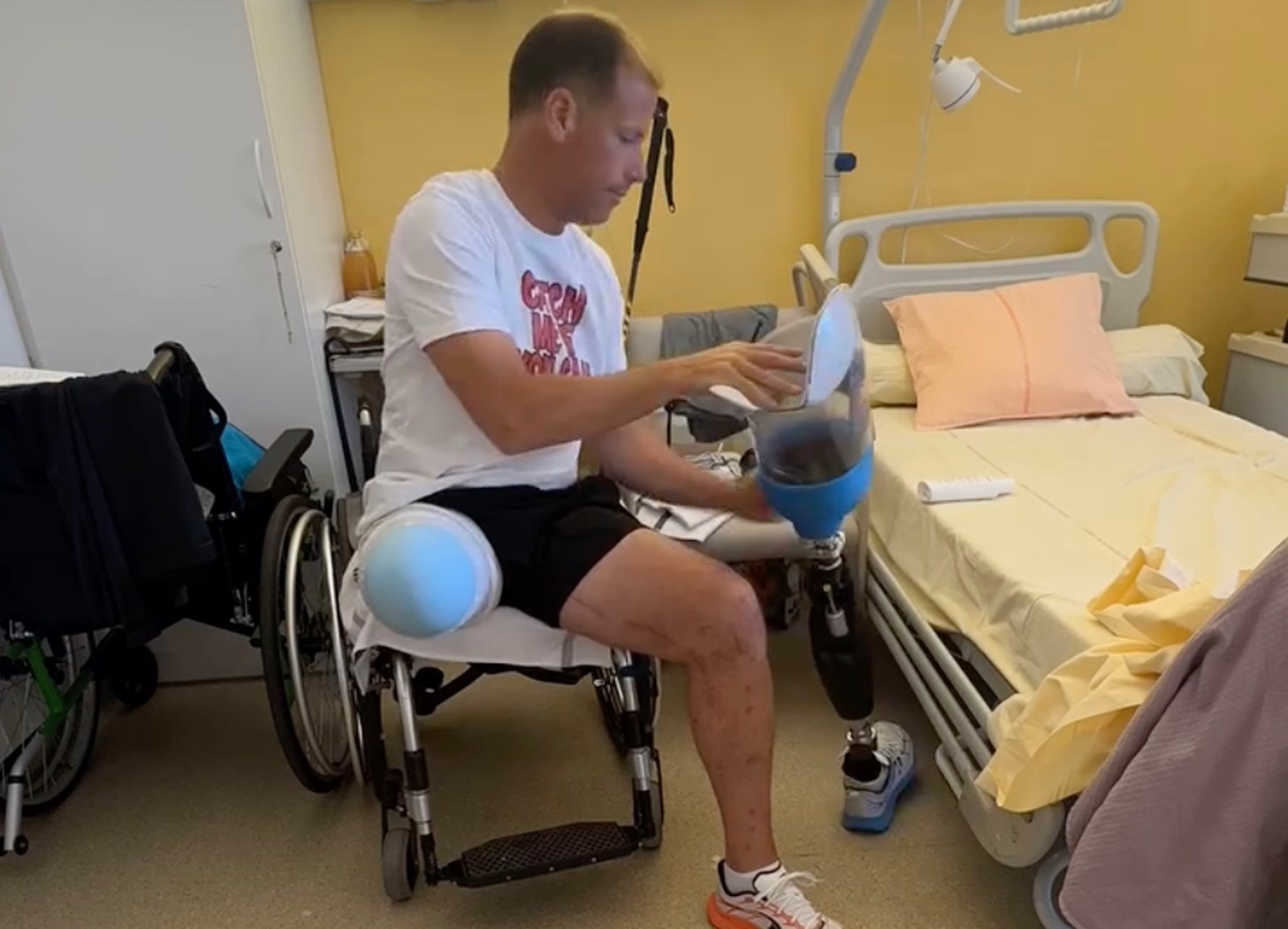 Powiedział lekarzom, by amputowali mu nogę. Po roku wrócił na szczyt