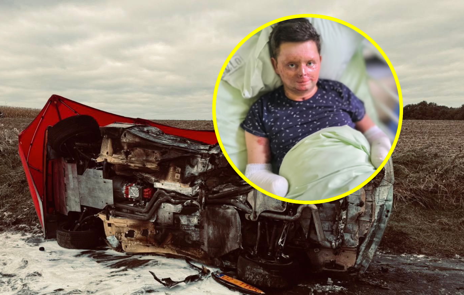 "Dostałem drugie życie". Po wypadku stracił obie dłonie