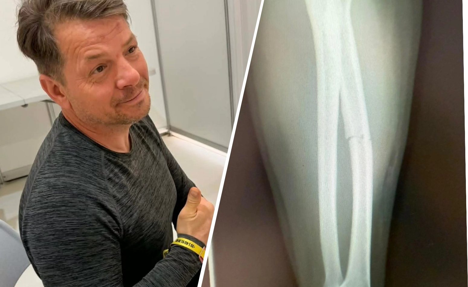 Wypadek Polaka w Rajdzie Dakar. "Mogło się to gorzej skończyć"