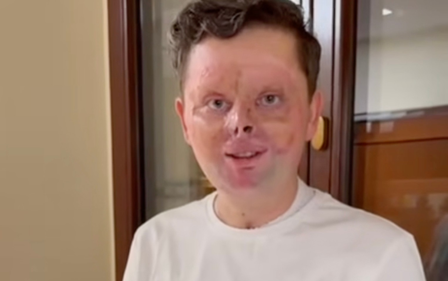 Maciej Krzysik nagrał film ze szpitala. "Chcę was uspokoić"