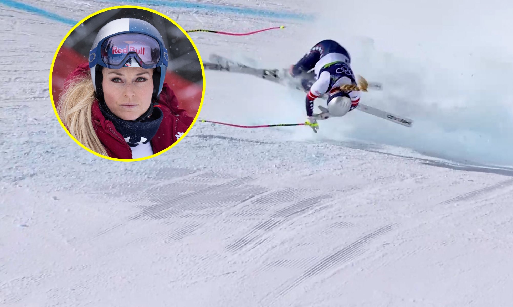 To powie córce. Ojciec Vonn ma rozdarte serce