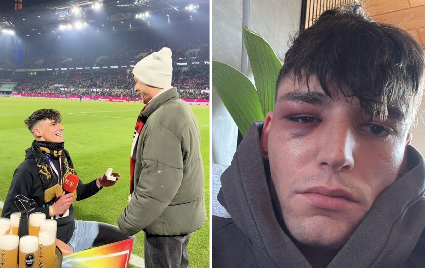 Oświadczył się partnerowi i został pobity. Najnowsze doniesienia są szokujące