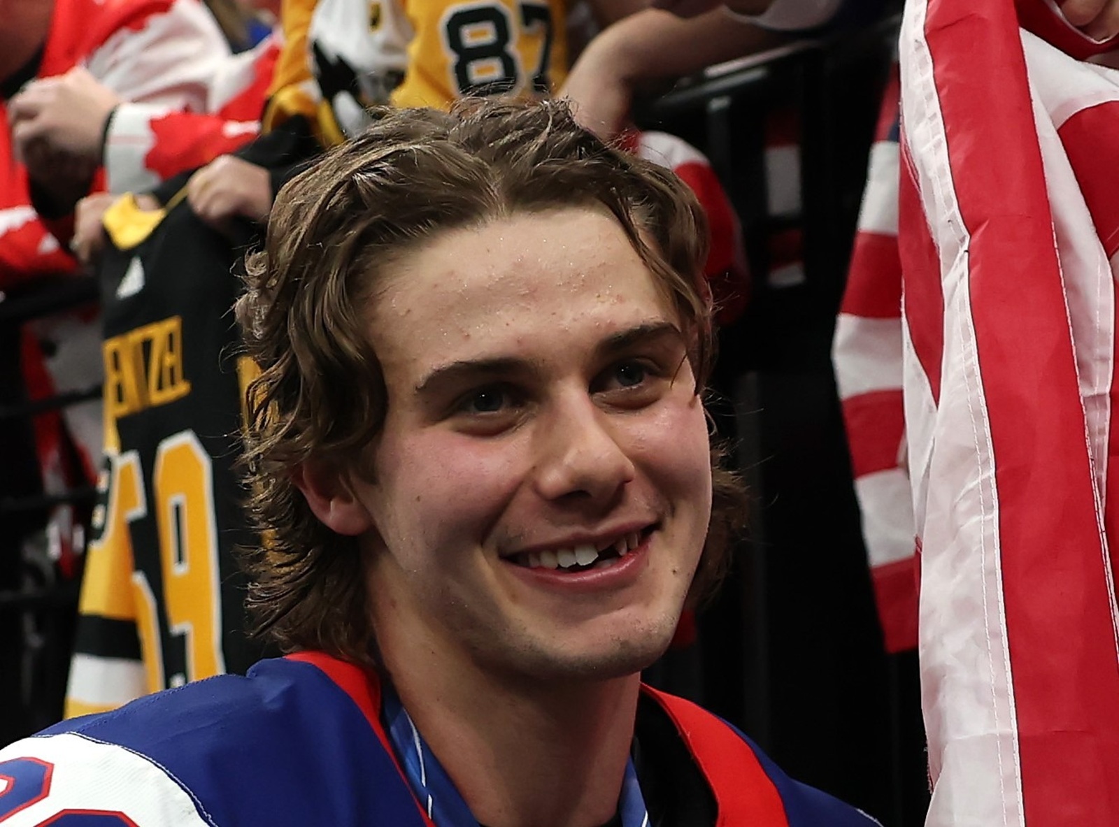 Zdobył złoto, stracił... zęby. Bolesna kontuzja bohatera USA