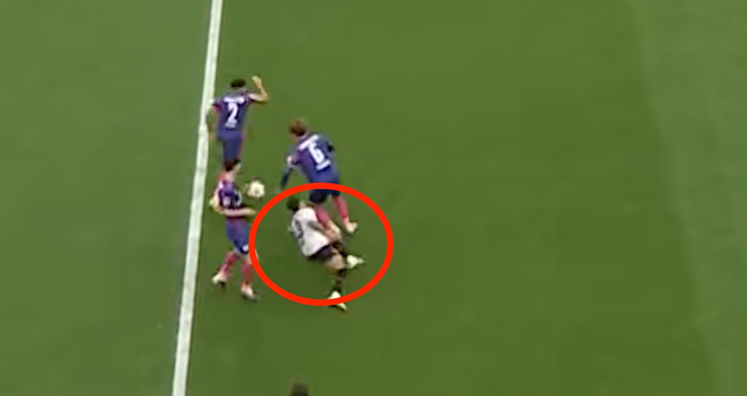 Dramatyczna kontuzja. Boli od samego patrzenia