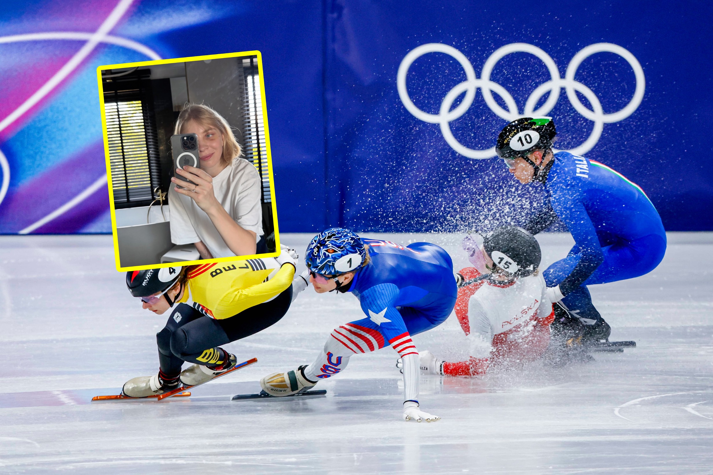 Po dramacie na igrzyskach Polka przeszła operację. Pokazała zdjęcia