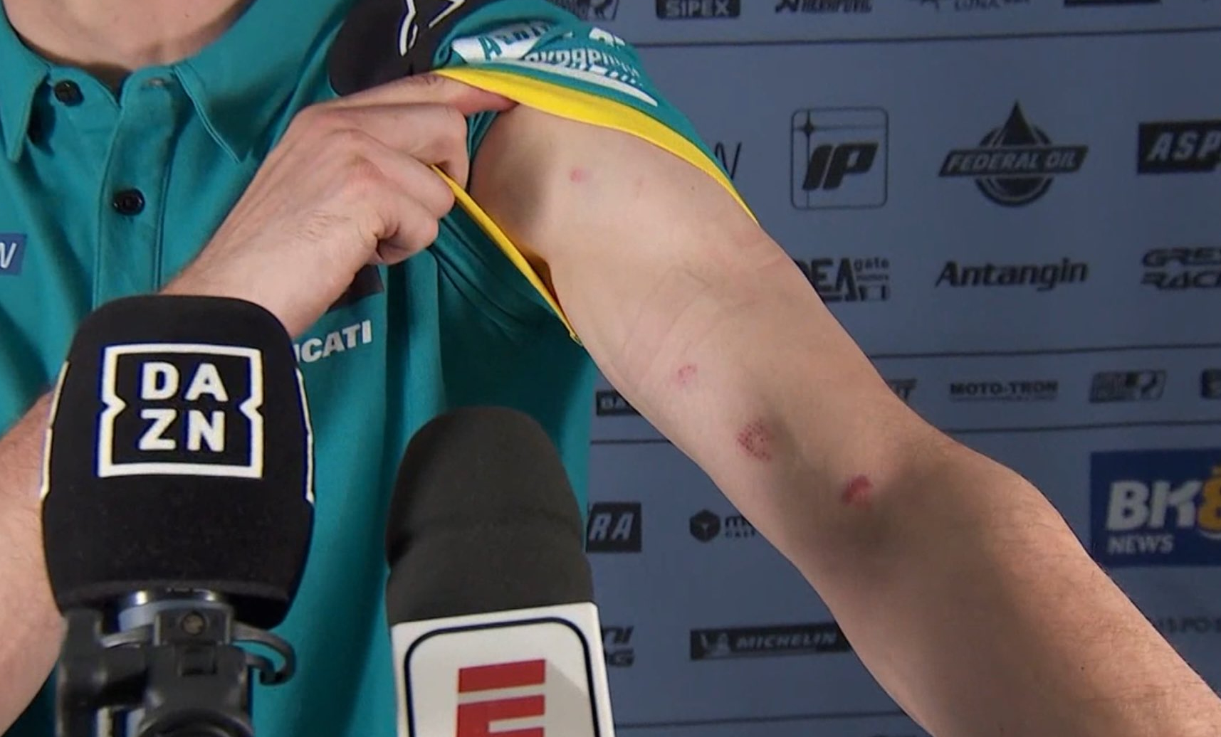 Skandal po rundzie MŚ w Brazylii. Zawodnicy pokazali obrażenia