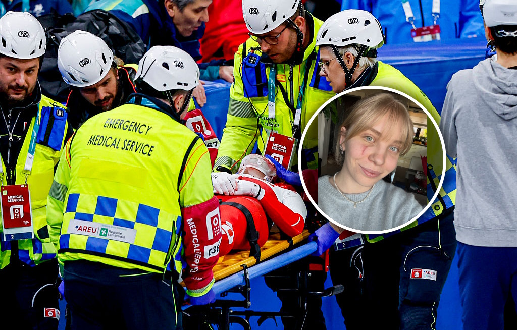 Tak wygląda twarz Polki po okropnym wypadku. Jej słowa mówią wszystko