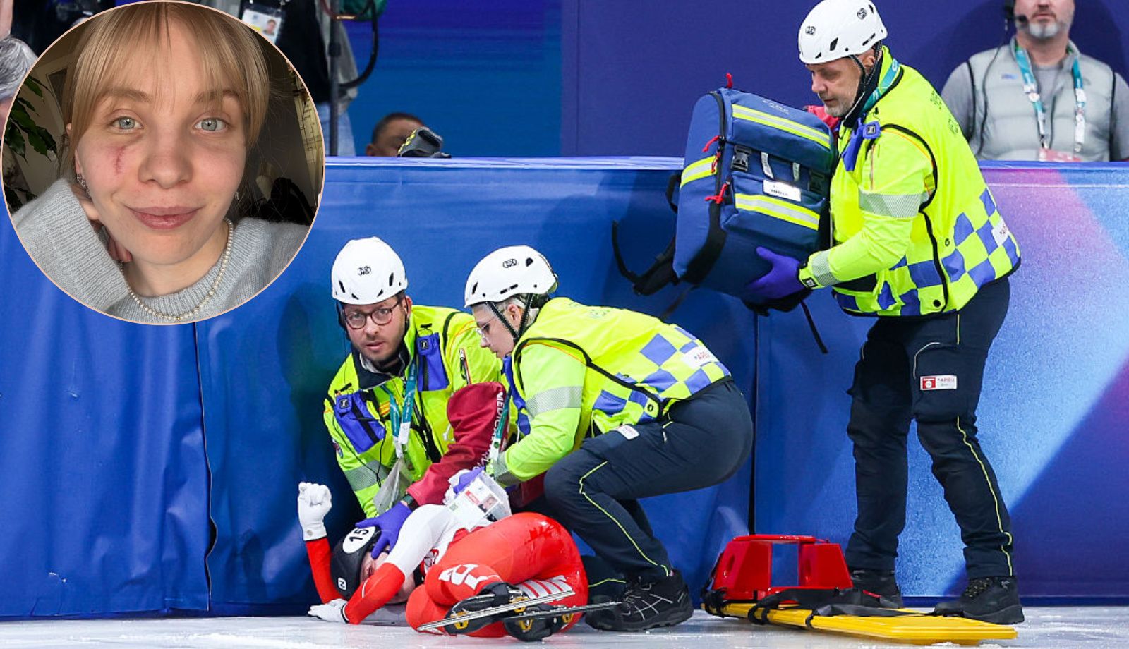 Jej wypadkiem żyła cała Polska. "Podwójne widzenie może zostać do końca życie"