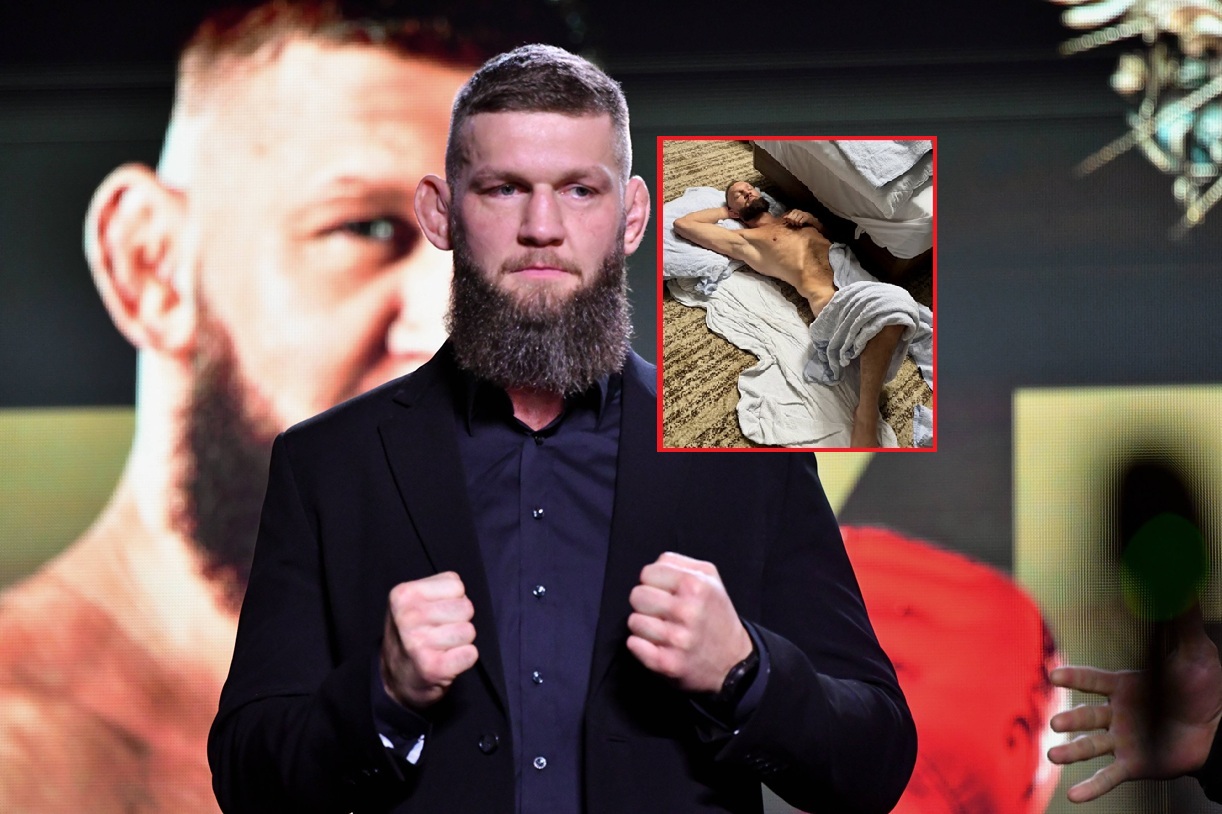Mistrz KSW pokazał ciemną stronę MMA. Wstrząsające zdjęcie