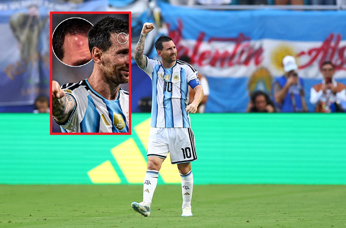 Messi poturbowany. Tylko spójrz, jak wyglądała jego twarz
