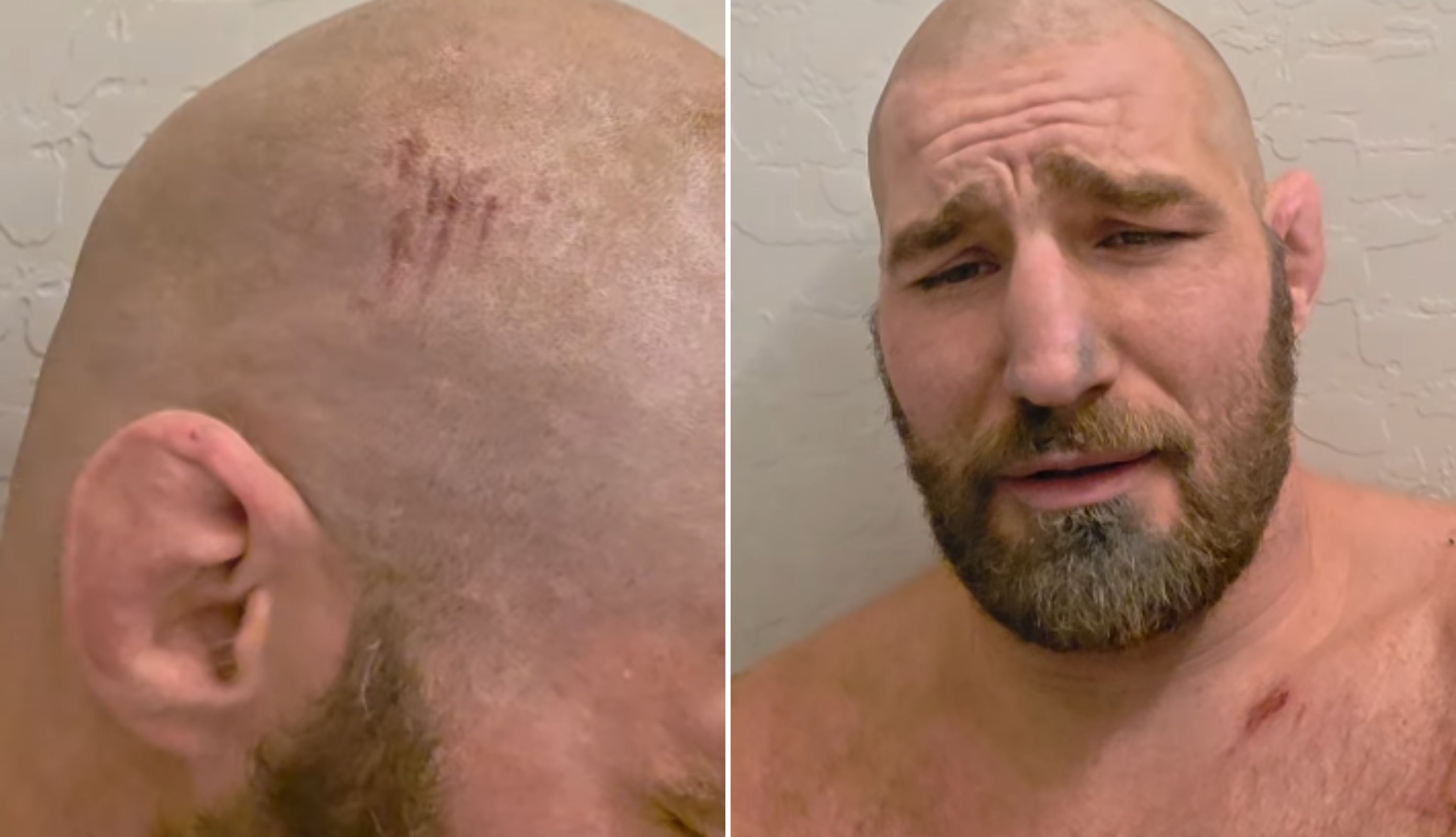 Groźny wypadek gwiazdy MMA. Jechał bez kasku. "Jestem idiotą"